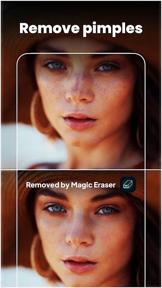 Magic Eraser - Remove Object