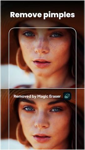 Magic Eraser - Remove Object